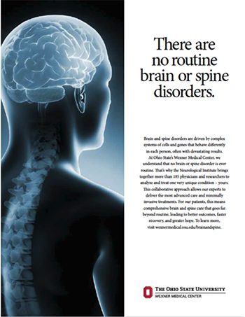 Ad with a blue side-view brain X-ray on the left and the headline 'There are no routine brain or spine disorders' on the right, plus small body text and The Ohio State University Wexner Medical Center logo at the bottom. | Jerad Schutt | Nashville Marketing Consultant | Fractional CMO | Jerad Schutt | Nashville Marketing Consultant | Fractional CMO