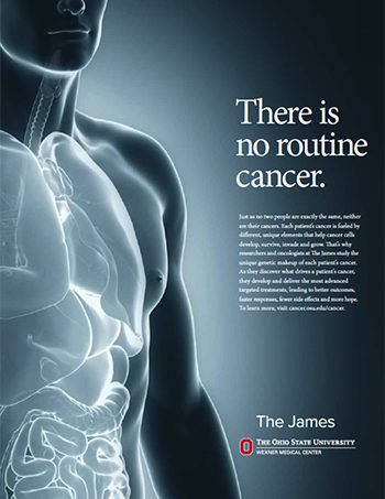 X-ray silhouette of a torso with the message: "There is no routine cancer" and The James OSU Wexner Medical Center logo. | Jerad Schutt | Nashville Marketing Consultant | Fractional CMO | Jerad Schutt | Nashville Marketing Consultant | Fractional CMO